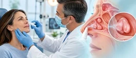 Иллюстрация к материалу: Полипозный риносинусит: способ доставки топического стероида может менять краткосрочный эффект
